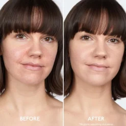 By Terry Ansikt|ByTerry Brightening CC Foundation