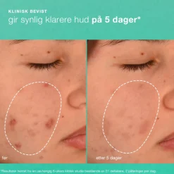 Dermalogica Ansiktskrem|Breakout Biotic Moisturizer