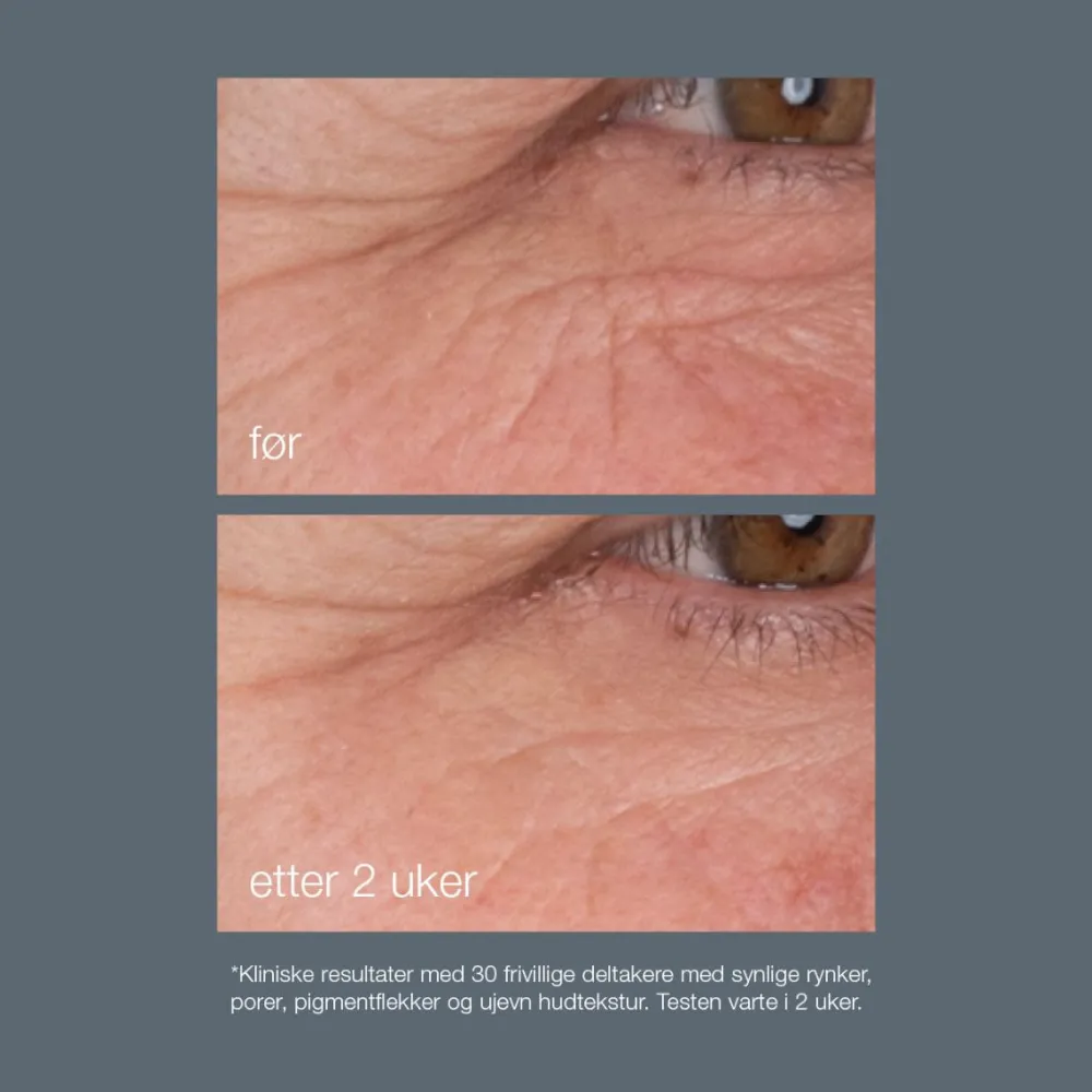 Dermalogica Ansiktskrem|Serum Og Ampuller|Dynamic Skin Retinol Serum