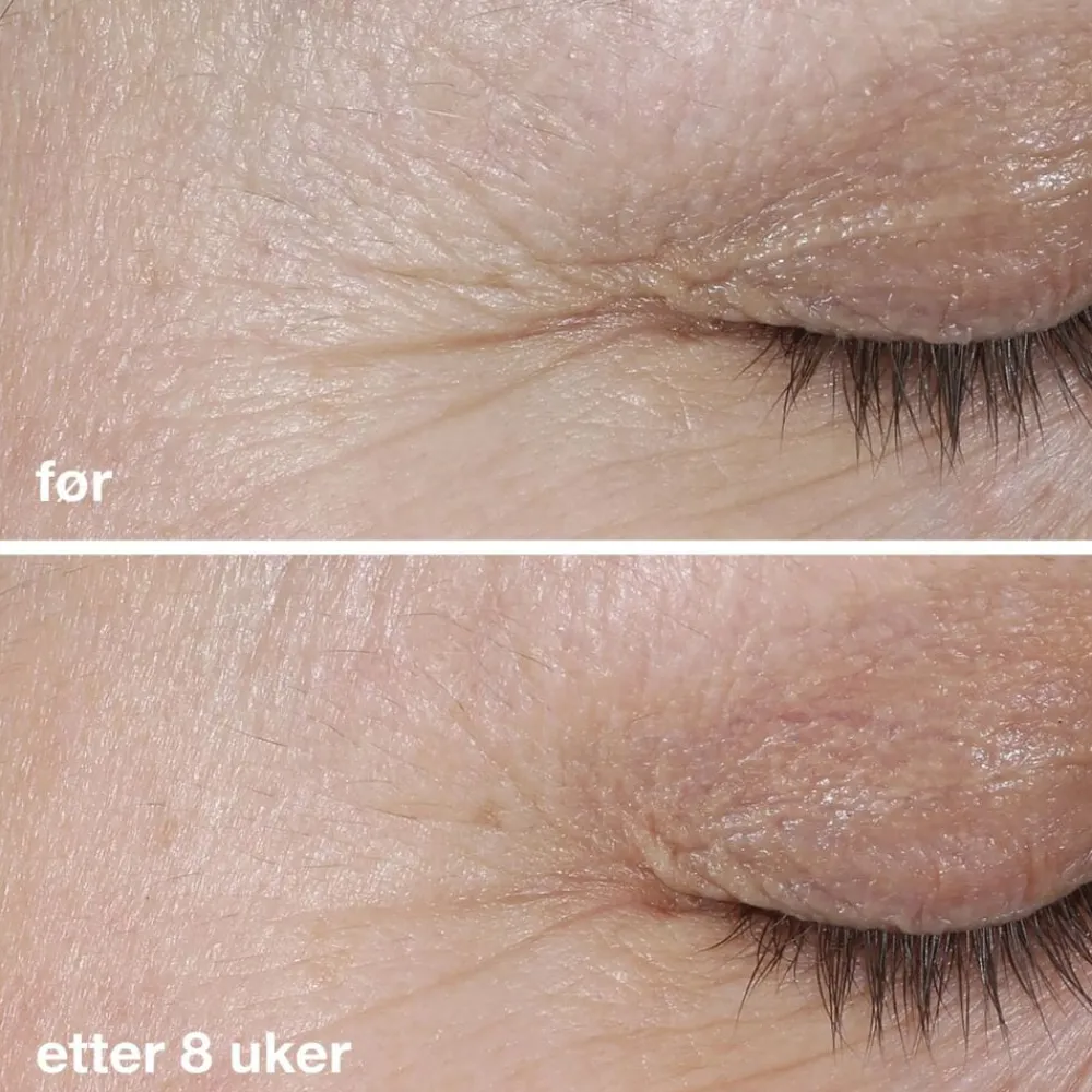 Dermalogica Serum Og Ampuller|Phyto Nature Firming Serum