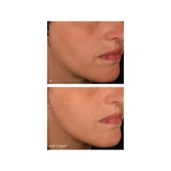 Dermalogica Serum Og Ampuller|Pro Collagen Banking Serum 30 ml