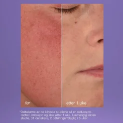 Dermalogica Ansiktskrem|UltraCalming Stabilizing Repair Cream