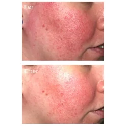 iS Clinical Serum Og Ampuller|Pro-Heal Serum Advance+ 15 ml