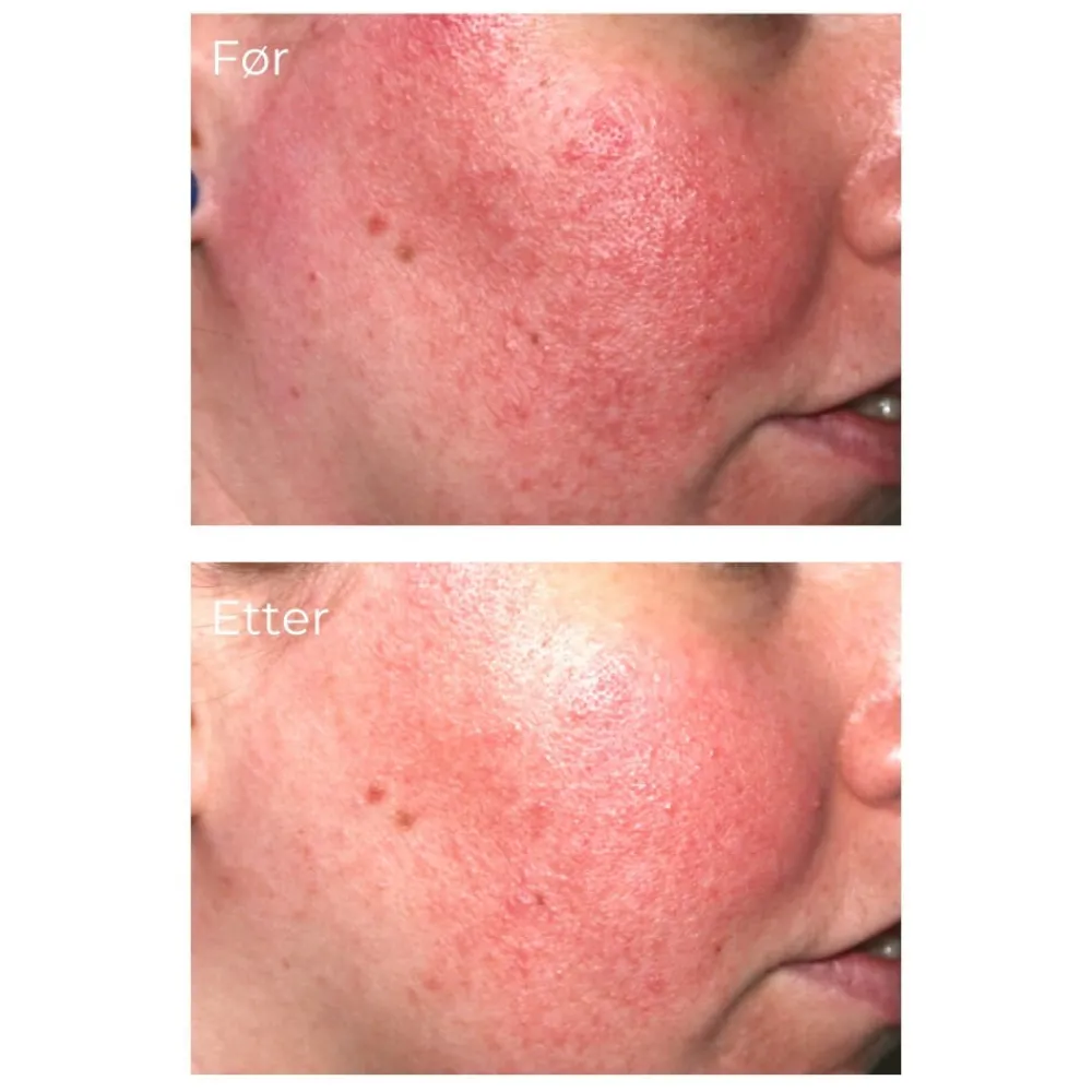 iS Clinical Serum Og Ampuller|Pro-Heal Serum Advance+ 15 ml