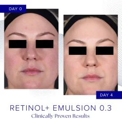 iS Clinical Ansiktskrem|Retinol+ Emulsion 0.3