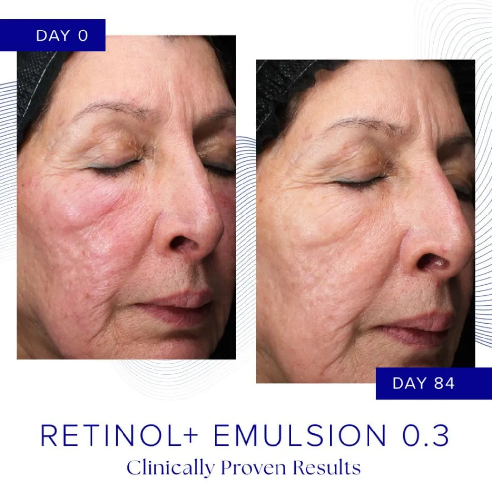 iS Clinical Ansiktskrem|Retinol+ Emulsion 0.3