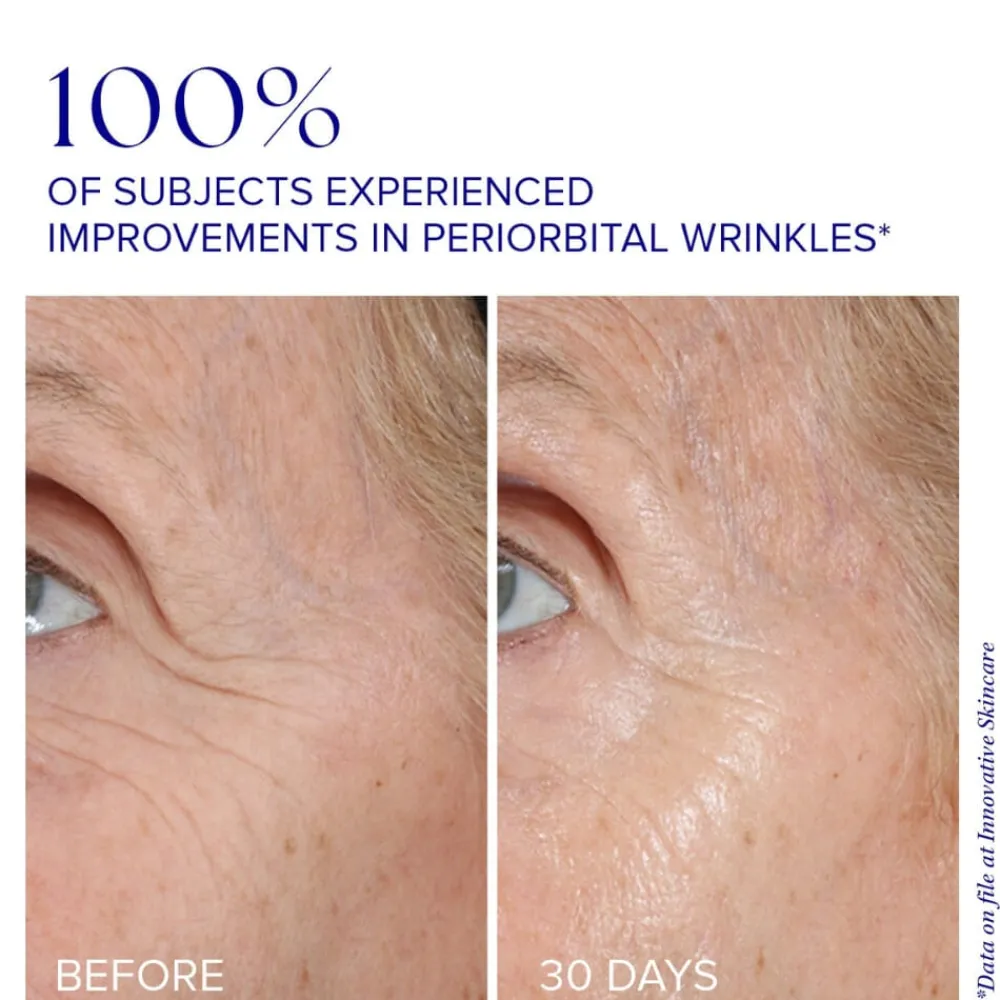 iS Clinical Øyepleie|Youth Eye Complex