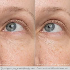 Obagi Medical Øyepleie|Obagi Daily Hydro-Drops Eye Gel Cream