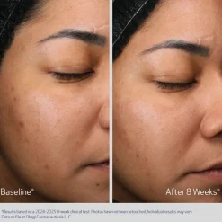 Obagi Medical Ansiktskrem|Obagi Retinol + PHA Refining Night Cream