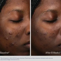 Obagi Medical Ansiktskrem|Obagi Retinol + PHA Refining Night Cream