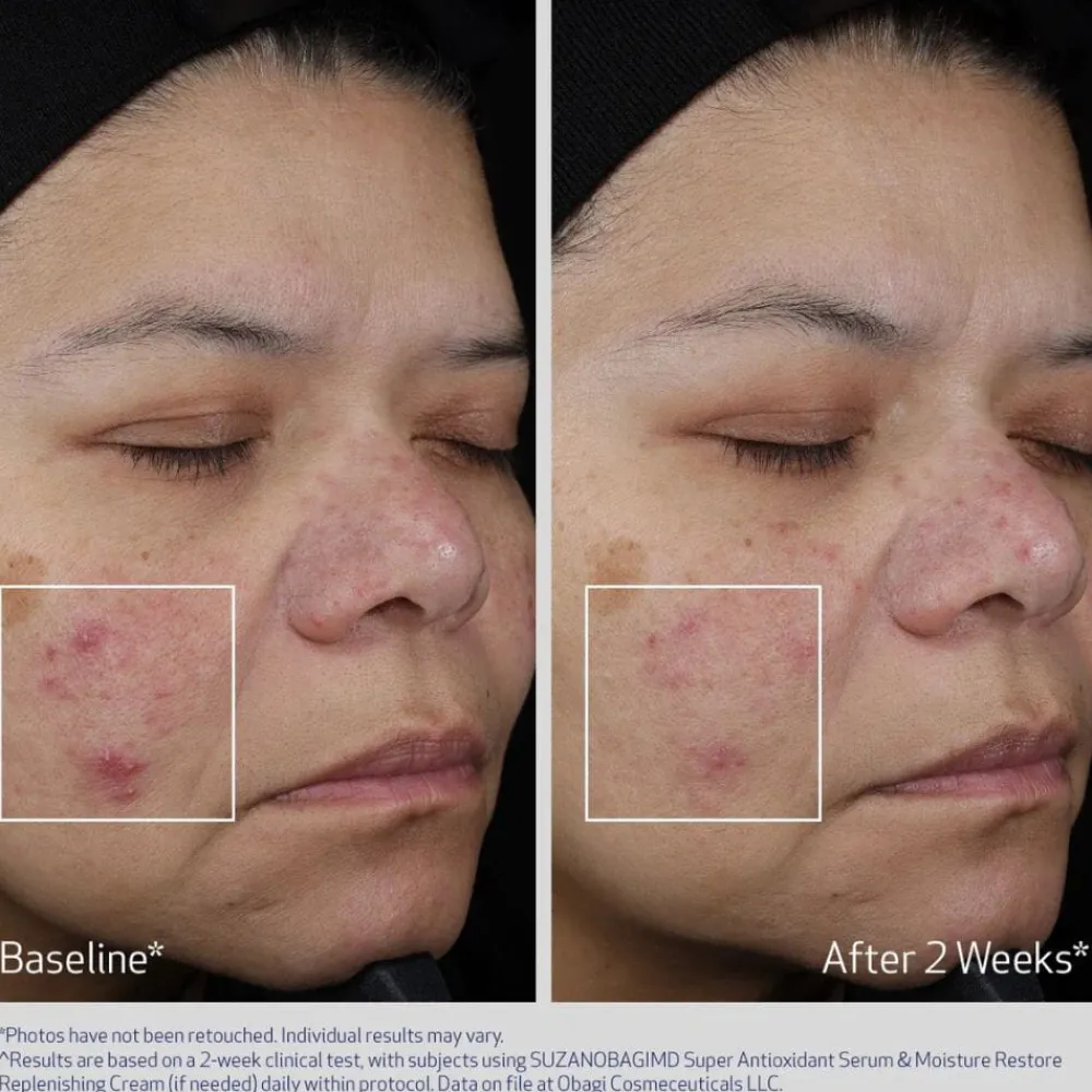 Obagi Medical Serum Og Ampuller|Obagi Super Antioxidant Serum