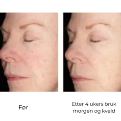 Skinbetter-Science Serum Og Ampuller|Skinbetter Alto Defense Serum Face