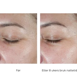 Skinbetter-Science Øyepleie|Skinbetter EyeMax AlphaRet Overnight Cream Eye