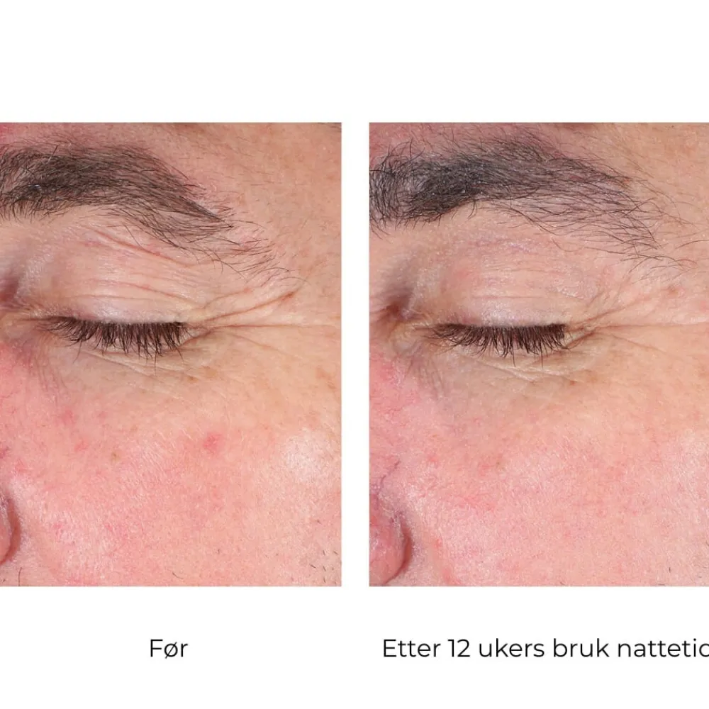 Skinbetter-Science Øyepleie|Skinbetter EyeMax AlphaRet Overnight Cream Eye