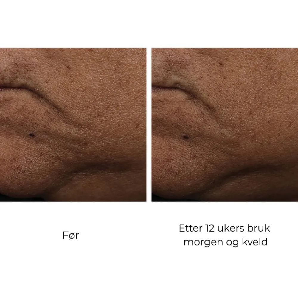 Skinbetter-Science Ansiktskrem|Skinbetter InterFuse Treatment Cream Face & Neck