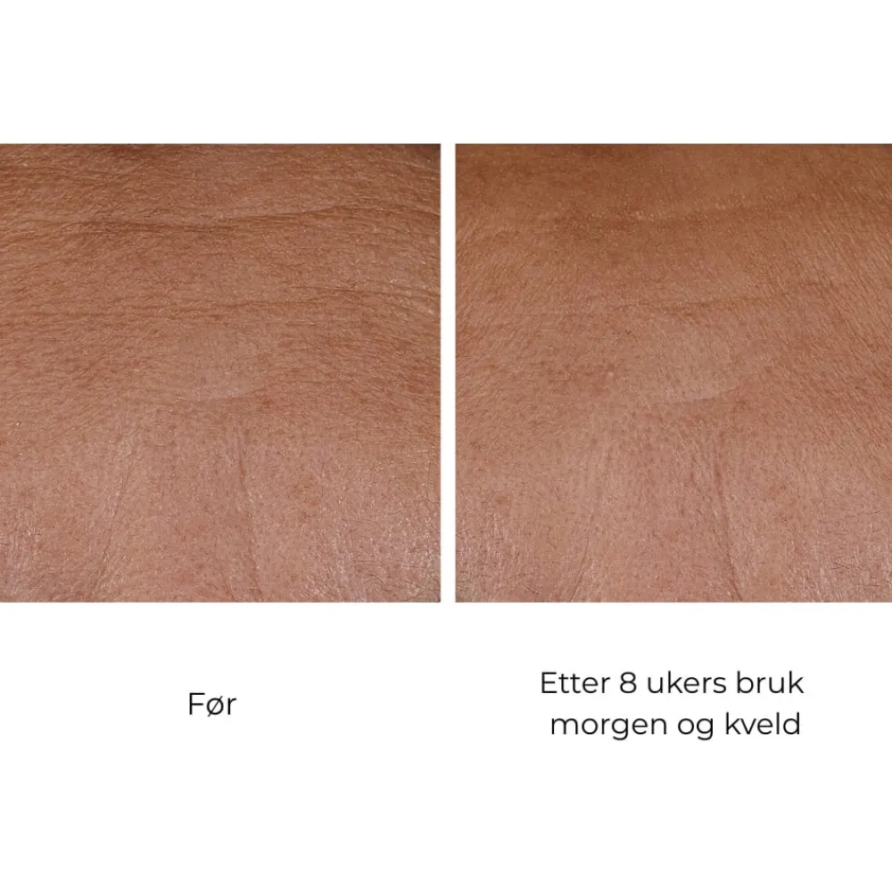 Skinbetter-Science Ansiktskrem|Skinbetter InterFuse Treatment Cream Face & Neck