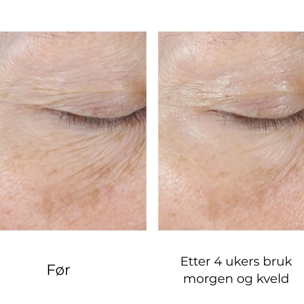 Skinbetter-Science Øyepleie|Skinbetter InterFuse Treatment Cream Eye