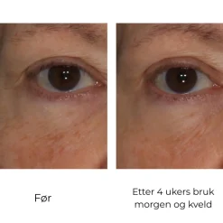 Skinbetter-Science Øyepleie|Skinbetter InterFuse Treatment Cream Eye