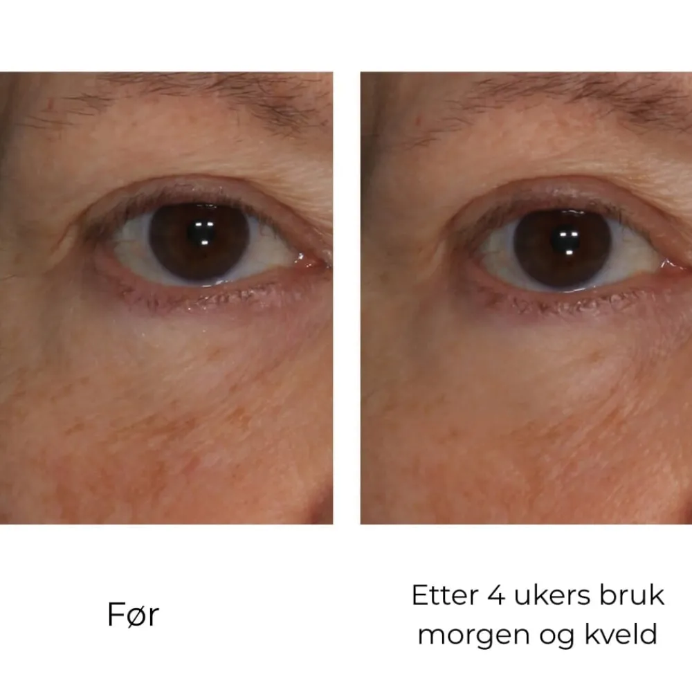 Skinbetter-Science Øyepleie|Skinbetter InterFuse Treatment Cream Eye