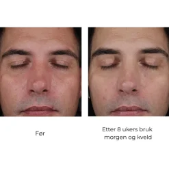 Skinbetter-Science Serum Og Ampuller|Skinbetter Mystro Active Balance Serum