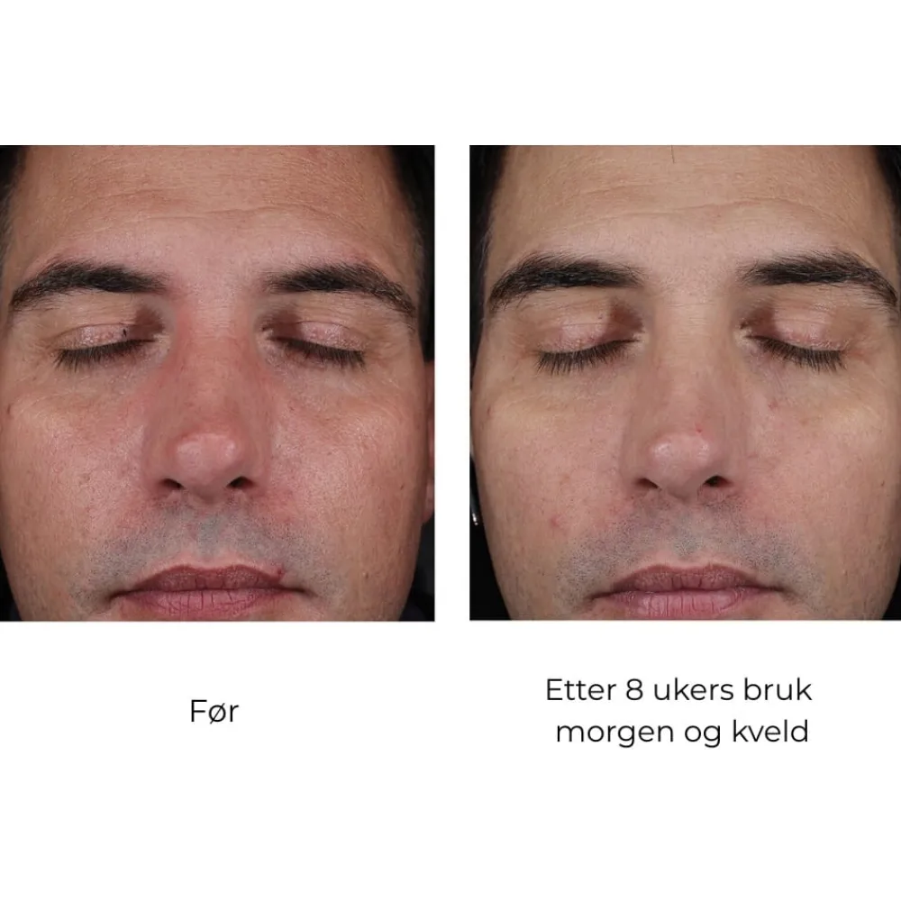 Skinbetter-Science Serum Og Ampuller|Skinbetter Mystro Active Balance Serum