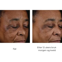 Skinbetter-Science Serum Og Ampuller|Skinbetter Mystro Active Balance Serum