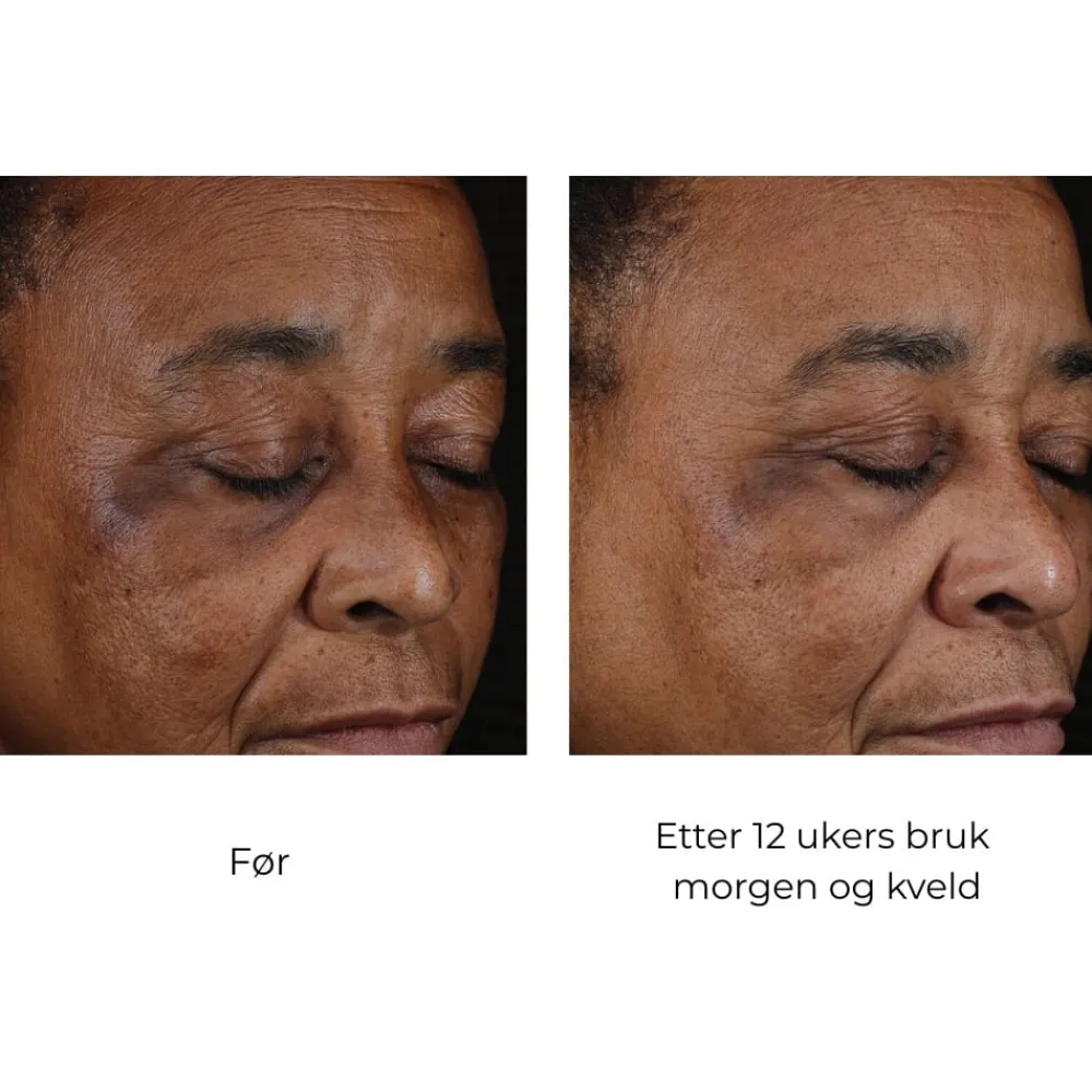 Skinbetter-Science Serum Og Ampuller|Skinbetter Mystro Active Balance Serum