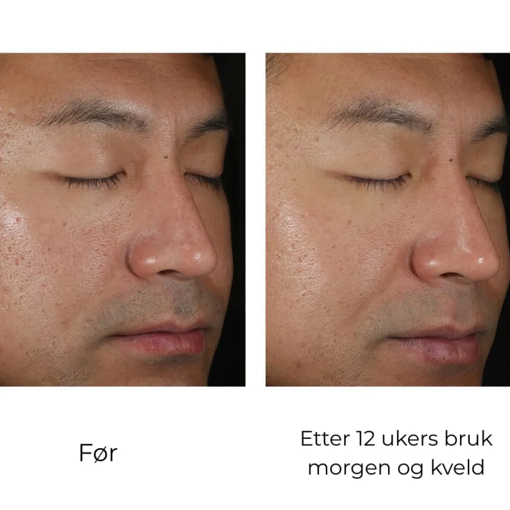 Skinbetter-Science Hudpleie|Ansiktskrem|Skinbetter Solo Hydrating Defense MEN