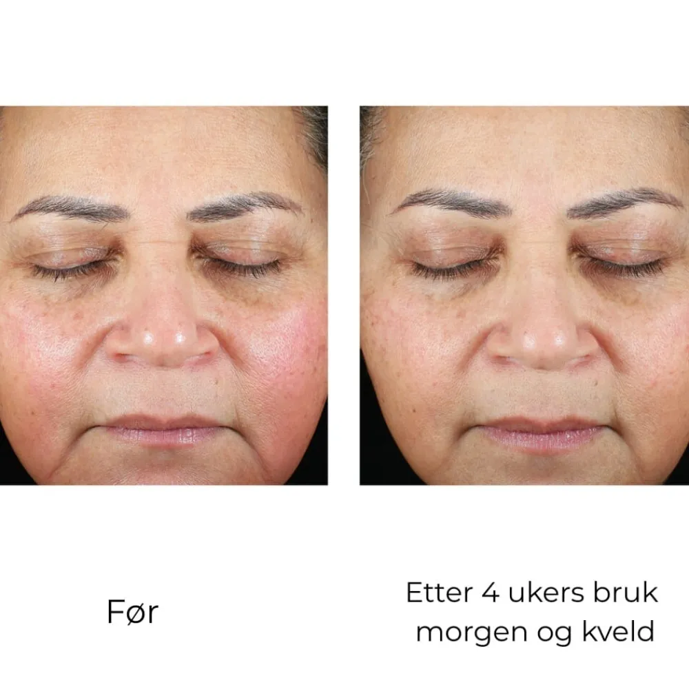 Skinbetter-Science Ansiktskrem|Skinbetter Trio Luxe Moisture Treatment