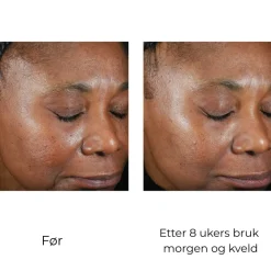 Skinbetter-Science Ansiktskrem|Skinbetter Trio Luxe Moisture Treatment