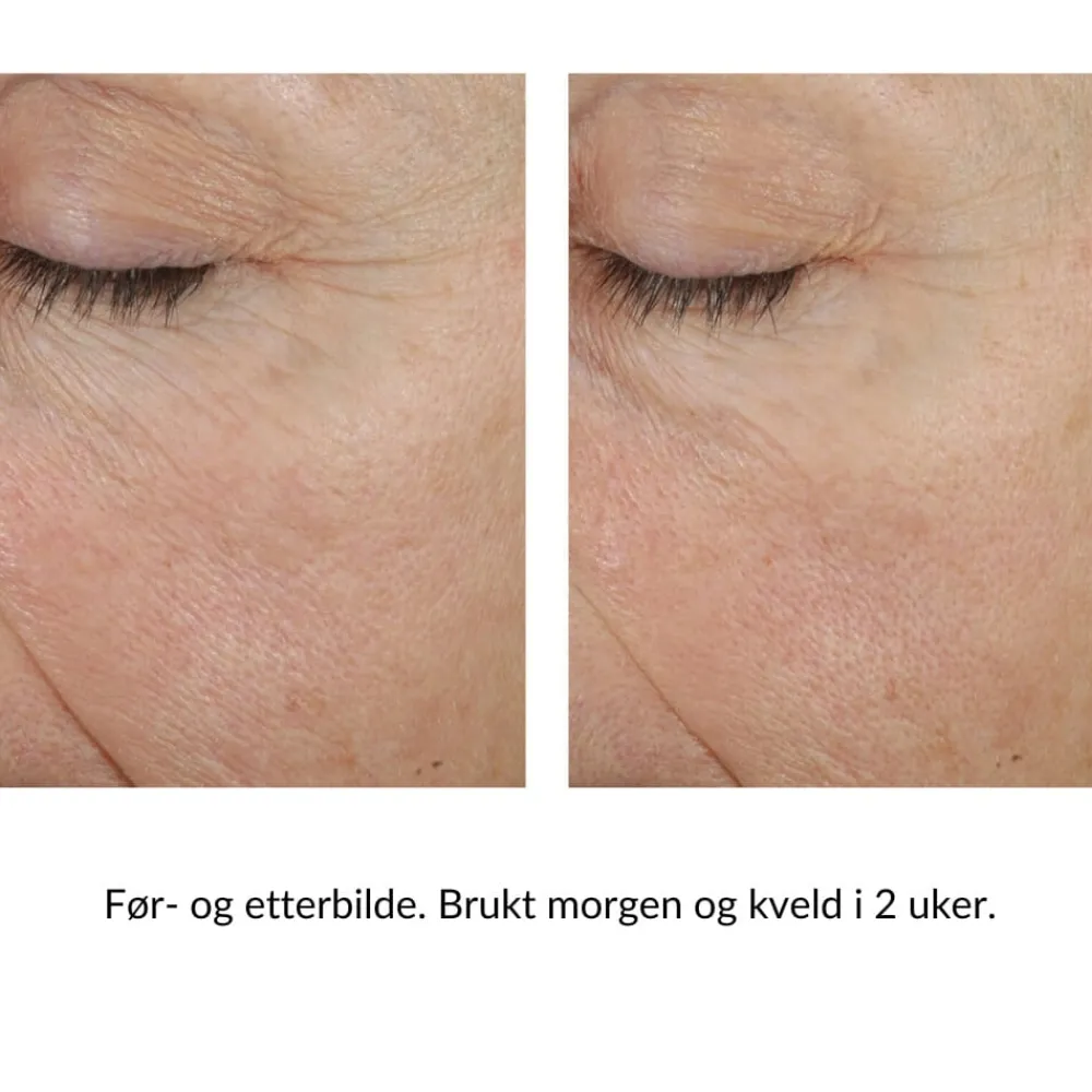 Skinbetter-Science Ansiktskrem|Skinbetter Trio Rebalancing Moisture Treatment