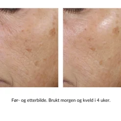 Skinbetter-Science Ansiktskrem|Skinbetter Trio Rebalancing Moisture Treatment