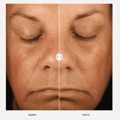 ZO Skin Health Ansiktskrem|ZO Retinol Skin Brightener 1%